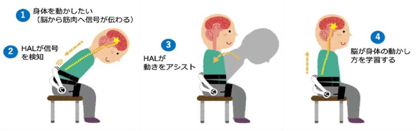 HAL®腰タイプを装着したリハビリテーション